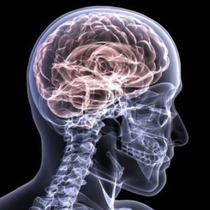 How to Deal With a Traumatic Brain Injury (TBI) After an Accident